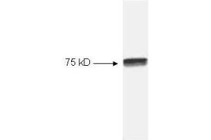 Western blot of HeLa cell extract.