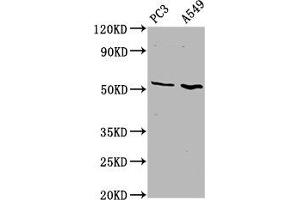 Western Blot Positive WB detected in: PC-3 whole cell lysate, A549 whole cell lysate All lanes: ETV5 antibody at 4. (ETV5 antibody  (AA 124-265))