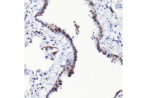 Immunohistochemistry of paraffin-embedded rat lung using RGS14 Rabbit pAb (ABIN6130669, ABIN6146917, ABIN6146918 and ABIN6225301) at dilution of 1:100 (40x lens). (RGS14 antibody  (AA 230-510))