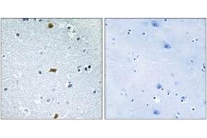 Immunohistochemistry (IHC) image for anti-Zinc Finger Homeobox 3 (ZFHX3) (AA 761-810) antibody (ABIN2889619) (ZFHX3 antibody  (AA 761-810))