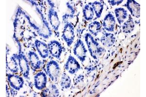 IHC analysis of VIP using anti-VIP antibody (ABIN4886760).