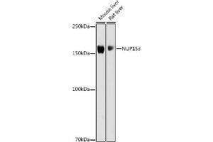 Western blot analysis of extracts of various cell lines, using NUP153 antibody (ABIN6133840, ABIN6144952 and ABIN7101835) at 1:1000 dilution.