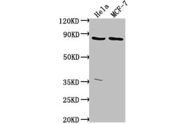 TTC39B antibody  (AA 10-122)