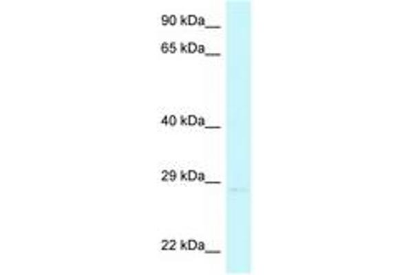 CHMP4A antibody  (C-Term)