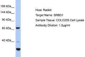 Host: Rabbit Target Name: SRBD1 Sample Type: COLO205 Whole Cell lysates Antibody Dilution: 1. (SRBD1 antibody  (C-Term))