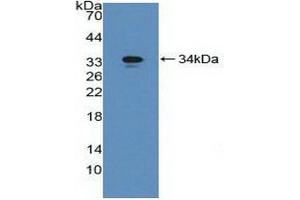 Detection of Recombinant gGT1, Mouse using Polyclonal Antibody to Gamma-Glutamyltransferase 1 (gGT1) (GGT1 antibody  (AA 296-537))