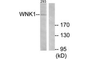 Western blot analysis of extracts from 293 cells, treated with EGF 200ng/ml 30', using WNK1 (Ab-58) Antibody. (WNK1 antibody  (AA 24-73))