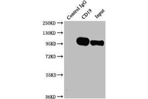 Immunoprecipitating CD19 in Raji whole cell lysate Lane 1: Rabbit control IgG instead of ABIN7127396 in Raji whole cell lysate. (Recombinant CD19 antibody)