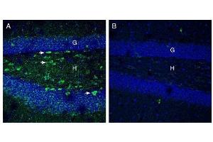 Expression of Netrin-1 in mouse hippocampus. (Netrin 1 (NTN1) Peptide)