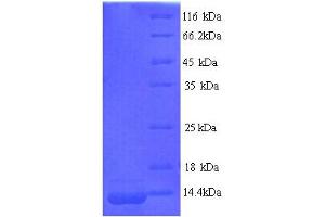 SDS-PAGE (SDS) image for WAP Four-Disulfide Core Domain 2 (WFDC2) (AA 31-124) protein (His tag) (ABIN7691195)