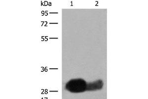 Western blot analysis of Raji cell Human spleen tissue lysates using HLA-DRB1 Polyclonal Antibody at dilution of 1:550 (HLA-DRB1 antibody)