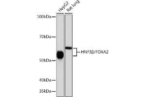Western blot analysis of extracts of various cell lines, using HNF3β/HNF3β/FOX antibody (ABIN7267232) at 1:1000 dilution. (FOXA2 antibody)