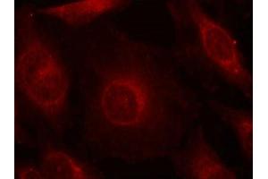 Immunofluorescence staining of methanol-fixed Hela cells using AKT1/AKT2/AKT3(phospho-Tyr315/316/312) Antibody.