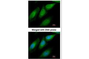 ICC/IF Image Immunofluorescence analysis of paraformaldehyde-fixed HeLa, using SUGT1, antibody at 1:200 dilution. (SUGT1 antibody  (Center))