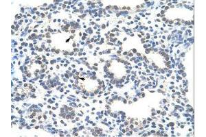 Image no. 1 for anti-Zinc Finger Protein 265 (Zranb2) (AA 149-198) antibody (ABIN6736297) (ZNF265 antibody  (AA 149-198))