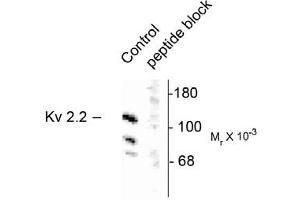 Image no. 1 for anti-Potassium Voltage-Gated Channel, Shab-Related Subfamily, Member 2 (KCNB2) antibody (ABIN305657)