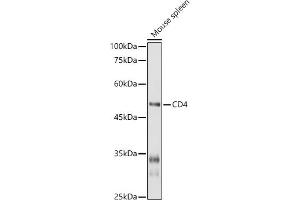 Western blot analysis of extracts of Mouse spleen, using CD4 antibody (ABIN6134777, ABIN6138187, ABIN6138189 and ABIN6213821) at 1:1000 dilution. (CD4 antibody  (AA 300-400))