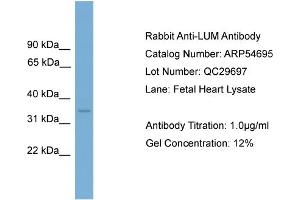 WB Suggested Anti-LUM  Antibody Titration: 0. (LUM antibody  (Middle Region))