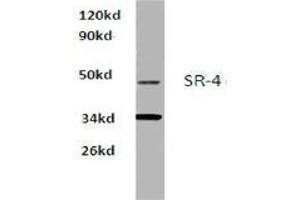 Western blot analysis of SR-4 Antibody  in extracts from Hela cells at 1/500 dilution.