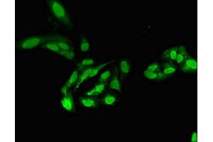 Immunofluorescent analysis of Hela cells using ABIN7169266 at dilution of 1:100 and Alexa Fluor 488-congugated AffiniPure Goat Anti-Rabbit IgG(H+L) (PPP2CA antibody  (Catalytic Subunit alpha))