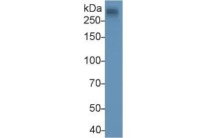 Detection of APOB in Human Serum using Monoclonal Antibody to Apolipoprotein B (APOB) (APOB antibody  (AA 3365-3548))