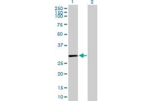 Western Blot analysis of C10orf63 expression in transfected 293T cell line by C10orf63 MaxPab polyclonal antibody. (ENKUR antibody  (AA 1-256))