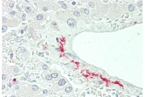 Formalin-fixed and paraffin-embedded H. (CFHR5 antibody  (AA 203-231))