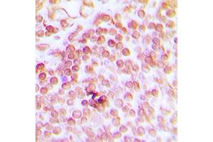 Immunohistochemical analysis of ERCC1 staining in human tonsil formalin fixed paraffin embedded tissue section. (ERCC1 antibody  (Center))