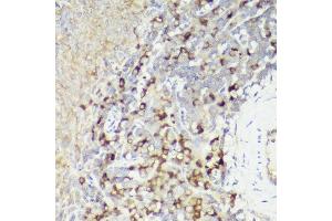 Immunohistochemistry of paraffin-embedded rat spleen using IL18 antibody (ABIN7267992) at dilution of 1:50 (40x lens). (IL-18 antibody)