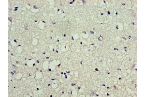 Immunohistochemistry of paraffin-embedded human brain tissue using ABIN7174208 at dilution of 1:100 (LSM1 antibody  (AA 1-123))