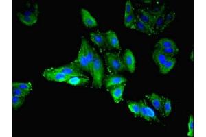 Immunofluorescent analysis of HepG2 cells using ABIN7158346 at dilution of 1:100 and Alexa Fluor 488-congugated AffiniPure Goat Anti-Rabbit IgG(H+L) (LIMS3 antibody  (AA 1-117))