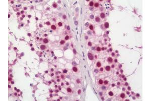 Human Testis: Formalin-Fixed, Paraffin-Embedded (FFPE) (FEN1 antibody  (AA 250-300))