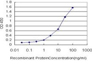 Detection limit for recombinant GST tagged CAMK2B is approximately 0. (CAMK2B antibody  (AA 1-503))