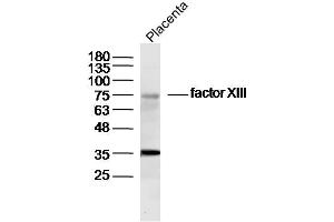 Mouse placenta lysates probed with factor XIII Polyclonal Antibody, Unconjugated  at 1:300 dilution and 4˚C overnight incubation. (Factor XIII antibody  (AA 331-732))