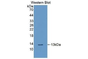 Detection of Recombinant PLXNB1, Human using Polyclonal Antibody to Plexin B1 (PLXNB1) (PLXNB1 antibody  (AA 200-727))