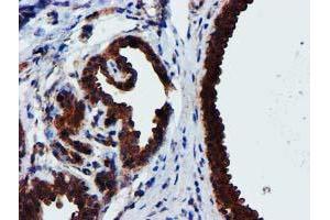 Immunohistochemical staining of paraffin-embedded Human breast tissue using anti-EPN2 mouse monoclonal antibody. (Epsin 2 antibody)