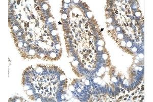 Complement C8b antibody was used for immunohistochemistry at a concentration of 4-8 ug/ml. (C8B antibody  (Middle Region))