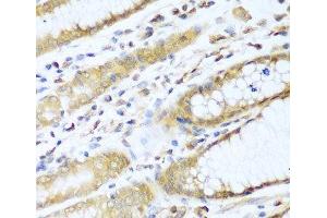Immunohistochemistry of paraffin-embedded Human stomach using UBE2L3 Polyclonal Antibody at dilution of 1:100 (40x lens). (UBE2L3 antibody)