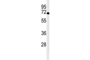Western blot analysis of XRCC6 antibody and A2058 lysate. (XRCC6 antibody  (AA 521-548))