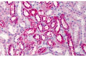 Human Kidney: Formalin-Fixed, Paraffin-Embedded (FFPE) (COMT antibody  (AA 52-65))