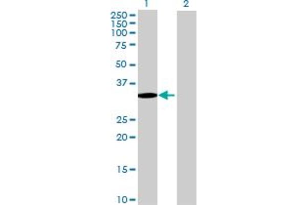 SETBP1 anticorps  (AA 1-242)