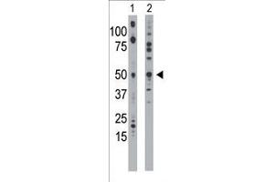 The anti-EKI1 Pab (ABIN391086 and ABIN2841227) is used in Western blot to detect EKI1 in mouse bladder tissue lysate (Lane 1) and 293 cell lysate (Lane 2). (Ethanolamine Kinase 1 antibody  (N-Term))