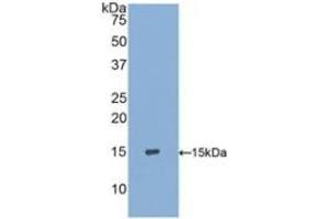 Detection of Recombinant S100A9, Human using Polyclonal Antibody to S100 Calcium Binding Protein A9 (S100A9) (S100A9 antibody  (AA 1-114))