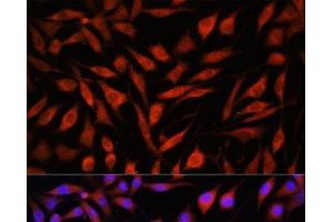 Immunofluorescence analysis of L929 cells using FBXO21 Polyclonal Antibody at dilution of 1:100. (FBXO21 antibody)