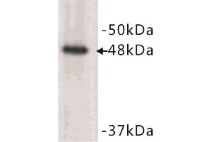 Western Blotting (WB) image for anti-Keratin 17 (KRT17) (N-Term) antibody (ABIN1854877) (KRT17 antibody  (N-Term))