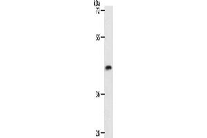 Western Blotting (WB) image for anti-Plasminogen Activator, Tissue (PLAT) antibody (ABIN2426912) (PLAT antibody)