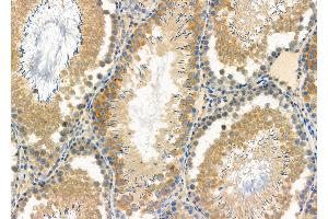 ABIN6261885 and ABIN6277125 at 1/100 staining Rat testis tissue by IHC-P. (GAS2L1 antibody  (C-Term))