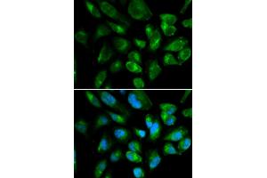 Immunofluorescence analysis of HepG2 cells using KIR2DL3 antibody (ABIN3212244). (KIR2DL3 antibody)