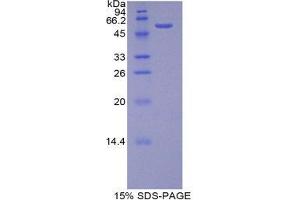 SDS-PAGE (SDS) image for beta-Site APP-Cleaving Enzyme 2 (BACE2) (AA 242-502) protein (His tag,GST tag) (ABIN1879504)