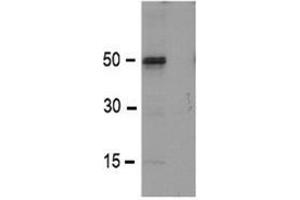 Western Blot using TMPRSS3 antibody. (TMPRSS3 antibody)